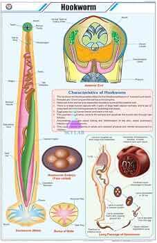 Hookworm Classification Educational Chart